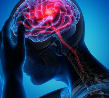 Ketika Otak Berteriak Diam-Diam: Mengungkap Bahaya Stroke yang Tak Terlihat
